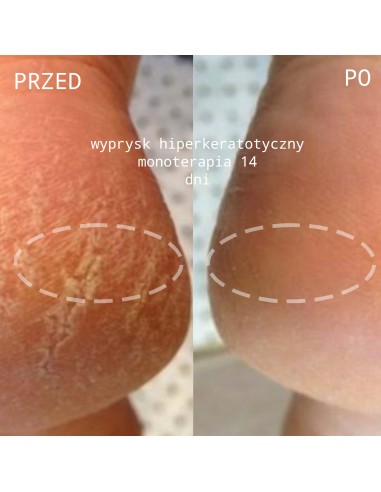 Natural Active Cream