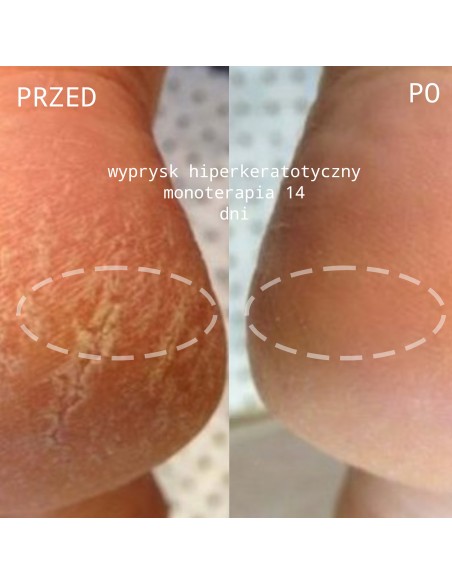 Natural Active Cream