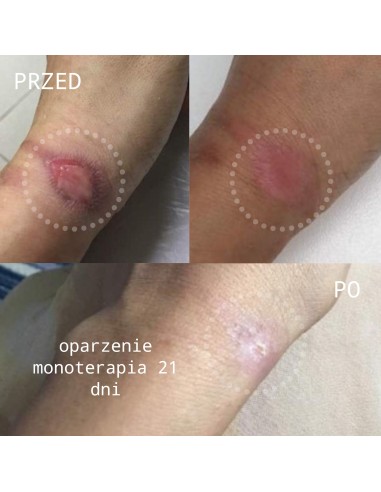 Natural Active Cream