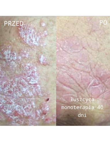 Natural Active Cream