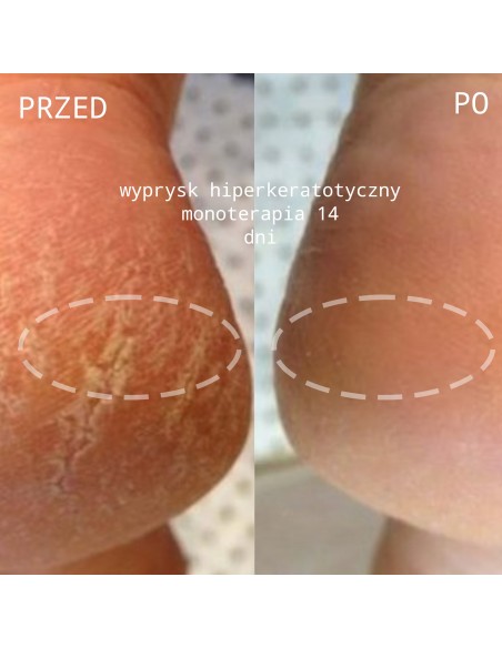 Natural Active Cream